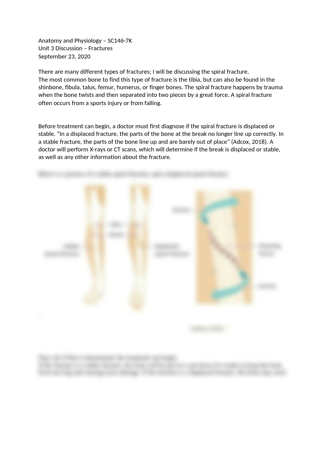 Unit 3 Discussion Fractures.docx_d2phfsmvjxk_page1