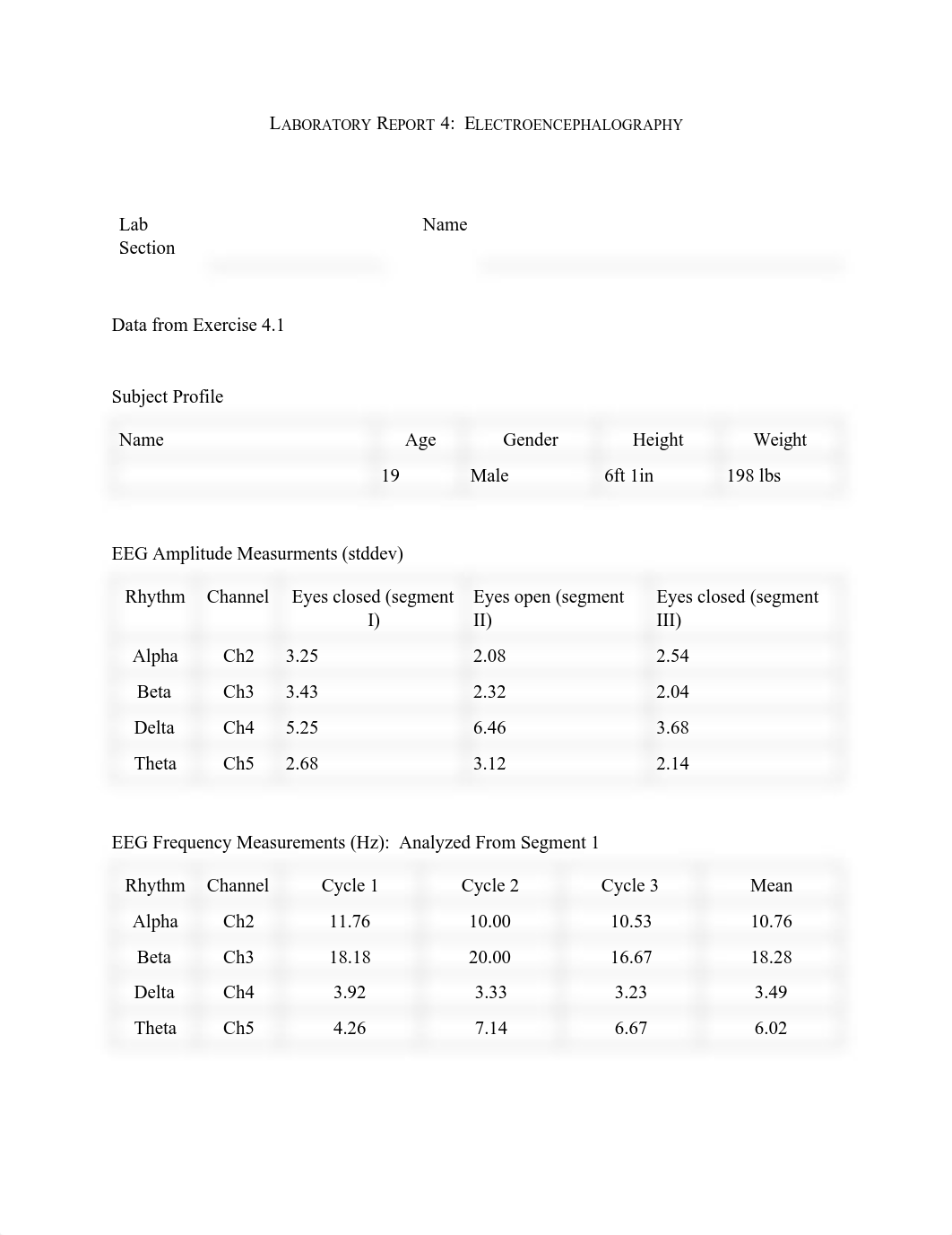 Lab 4 EEG.pdf_d2sotitthb0_page1