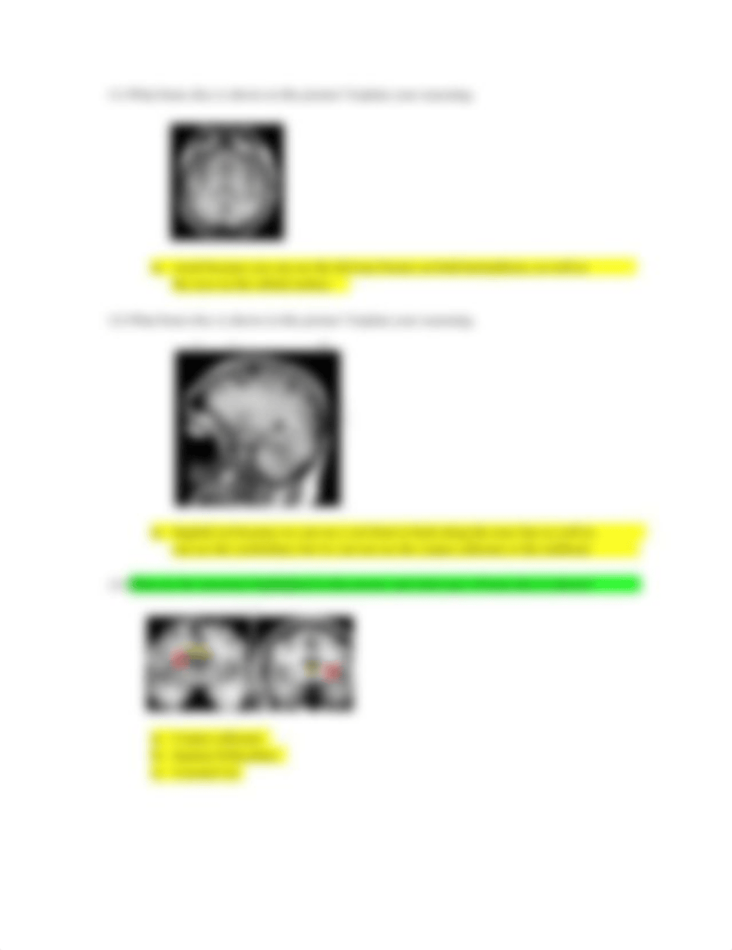 Neuro Exam 1.pdf_d2tyjcwm8pa_page4