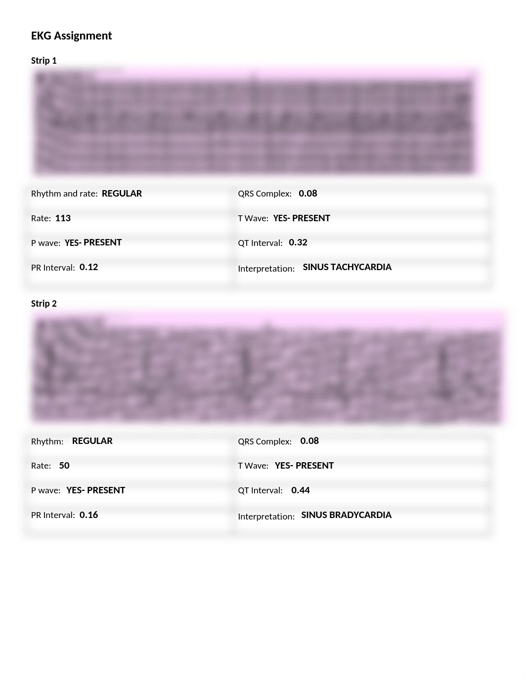 EKG assignment(1).docx_d2wens0jp35_page1