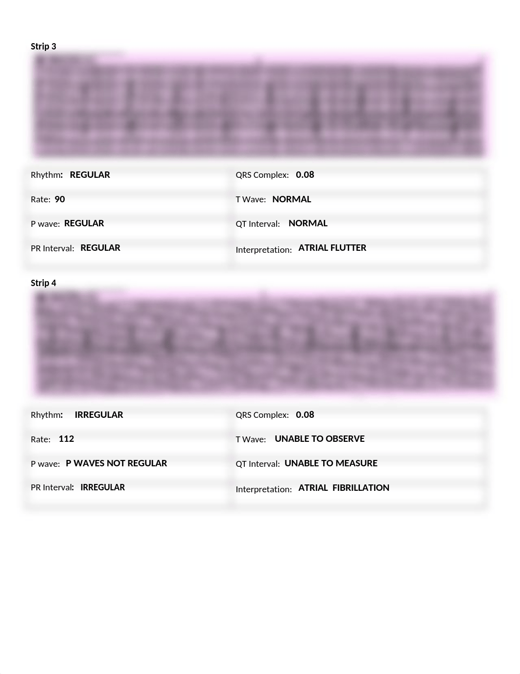 EKG assignment(1).docx_d2wens0jp35_page2