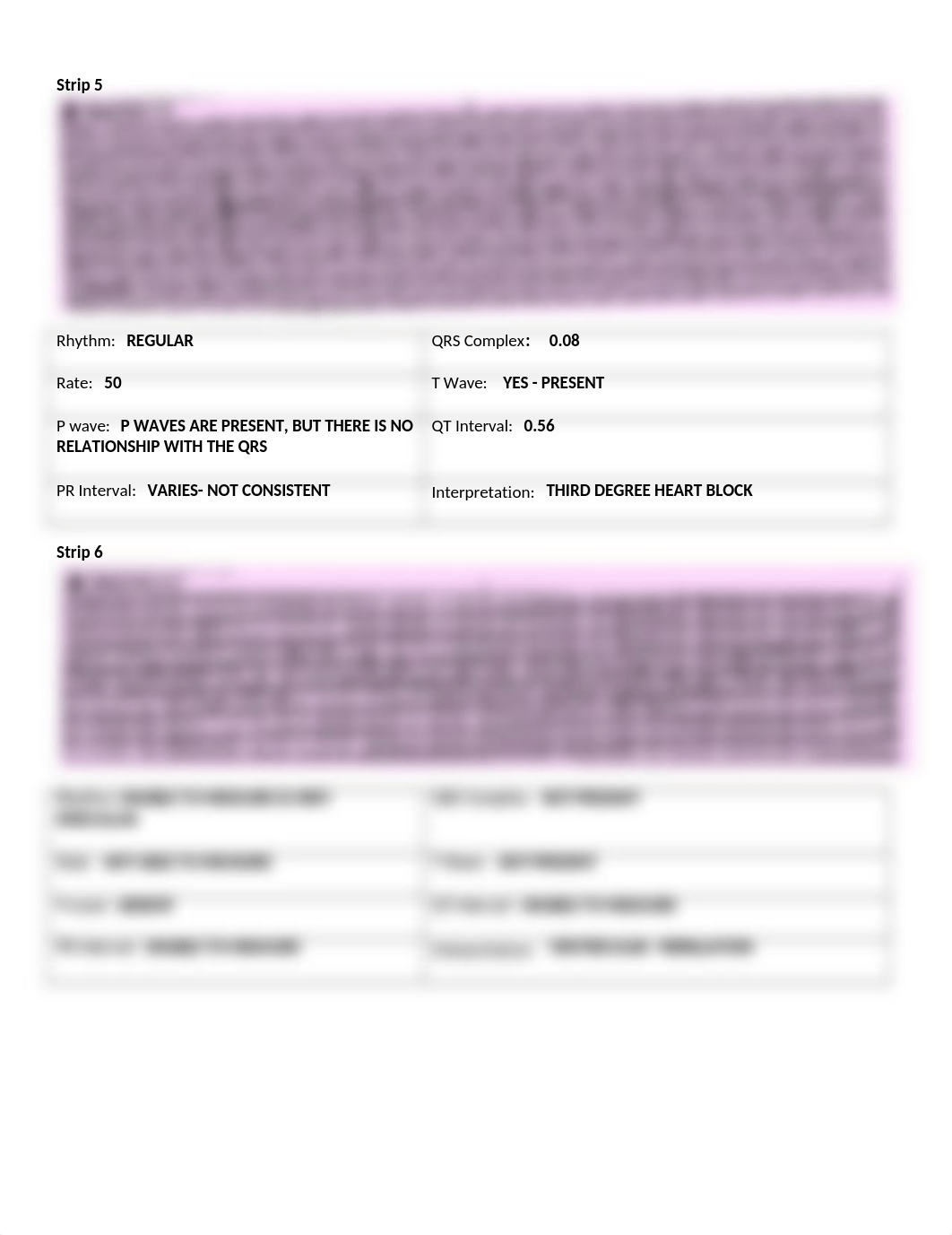 EKG assignment(1).docx_d2wens0jp35_page3