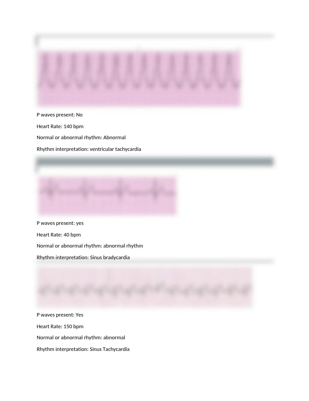 EKG Packet 2021 (1).docx_d2yffm6zus1_page1