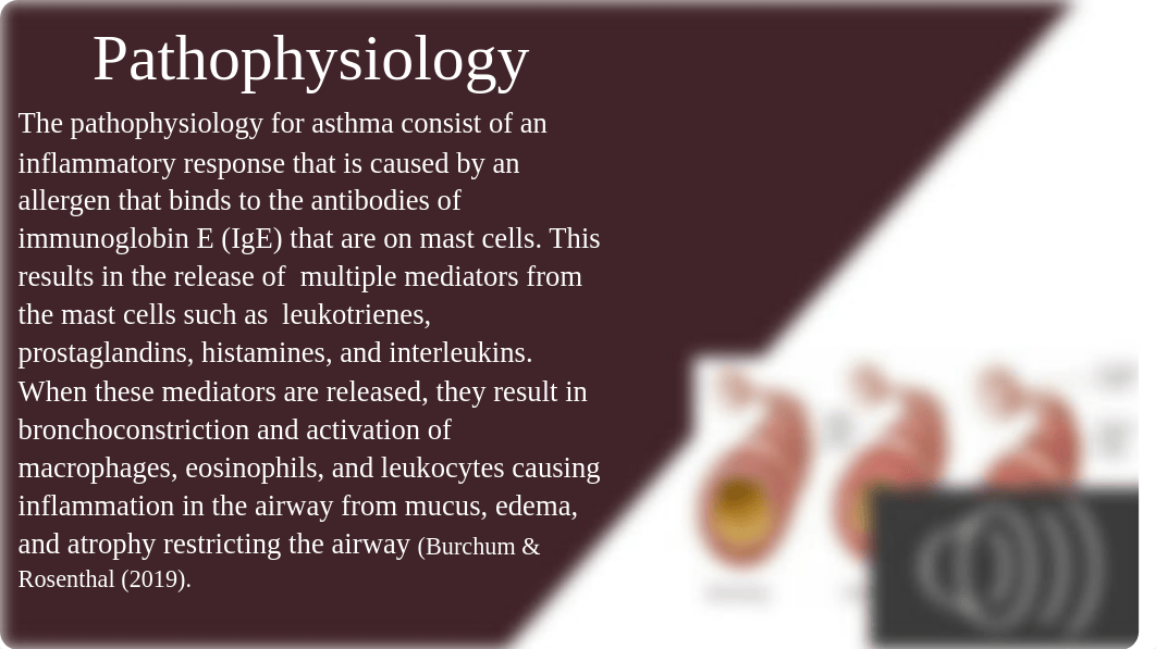 Asthma Special Topic Project.pptx_d2zdfq97bvt_page3