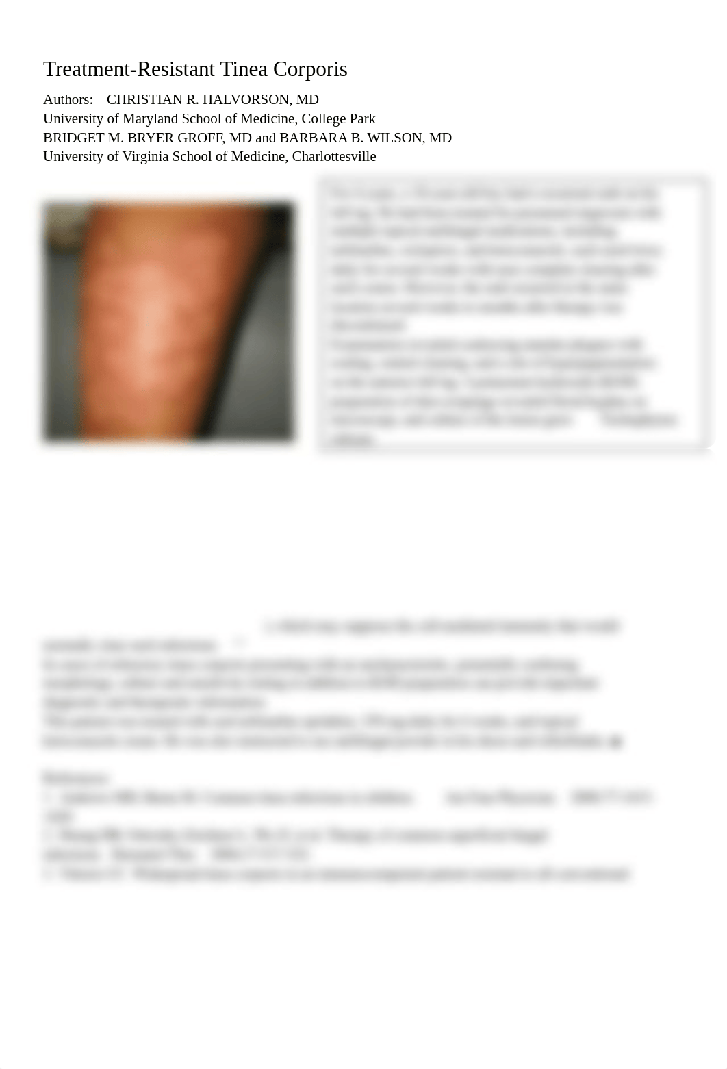 Treatment Resistant Tinea Corporis.doc_d323mwle1mb_page1