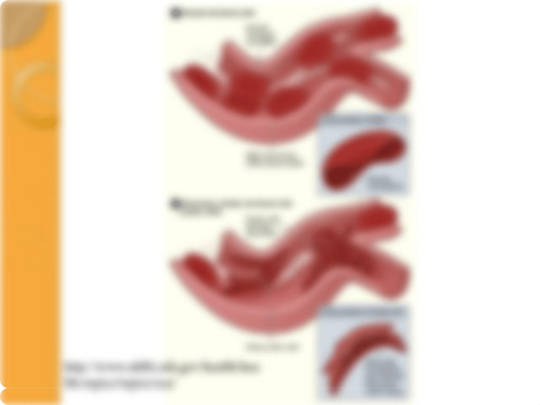 NUR113 sickle cell(1).pptx_d32qo9qb47b_page4