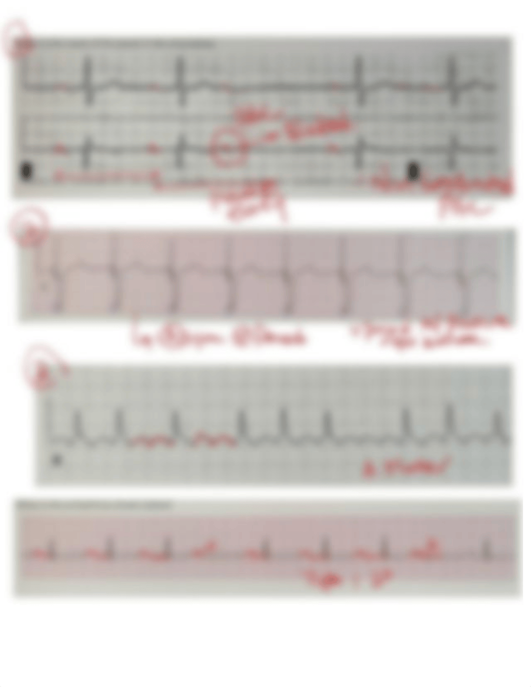 Ekg Final.pdf_d33arqa0zp1_page1