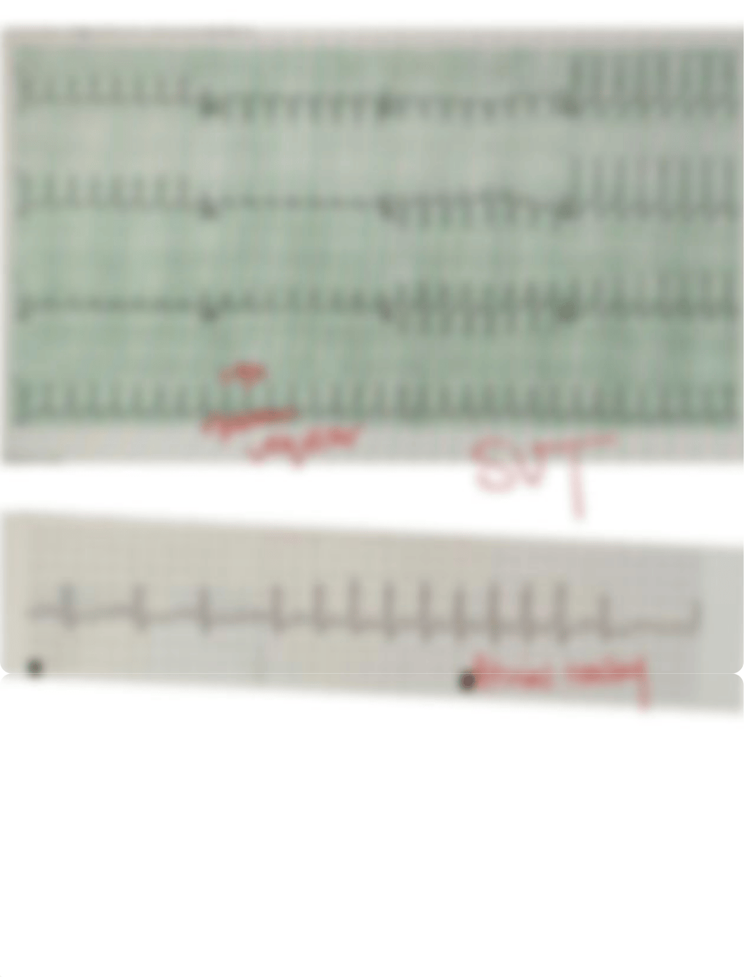 Ekg Final.pdf_d33arqa0zp1_page4