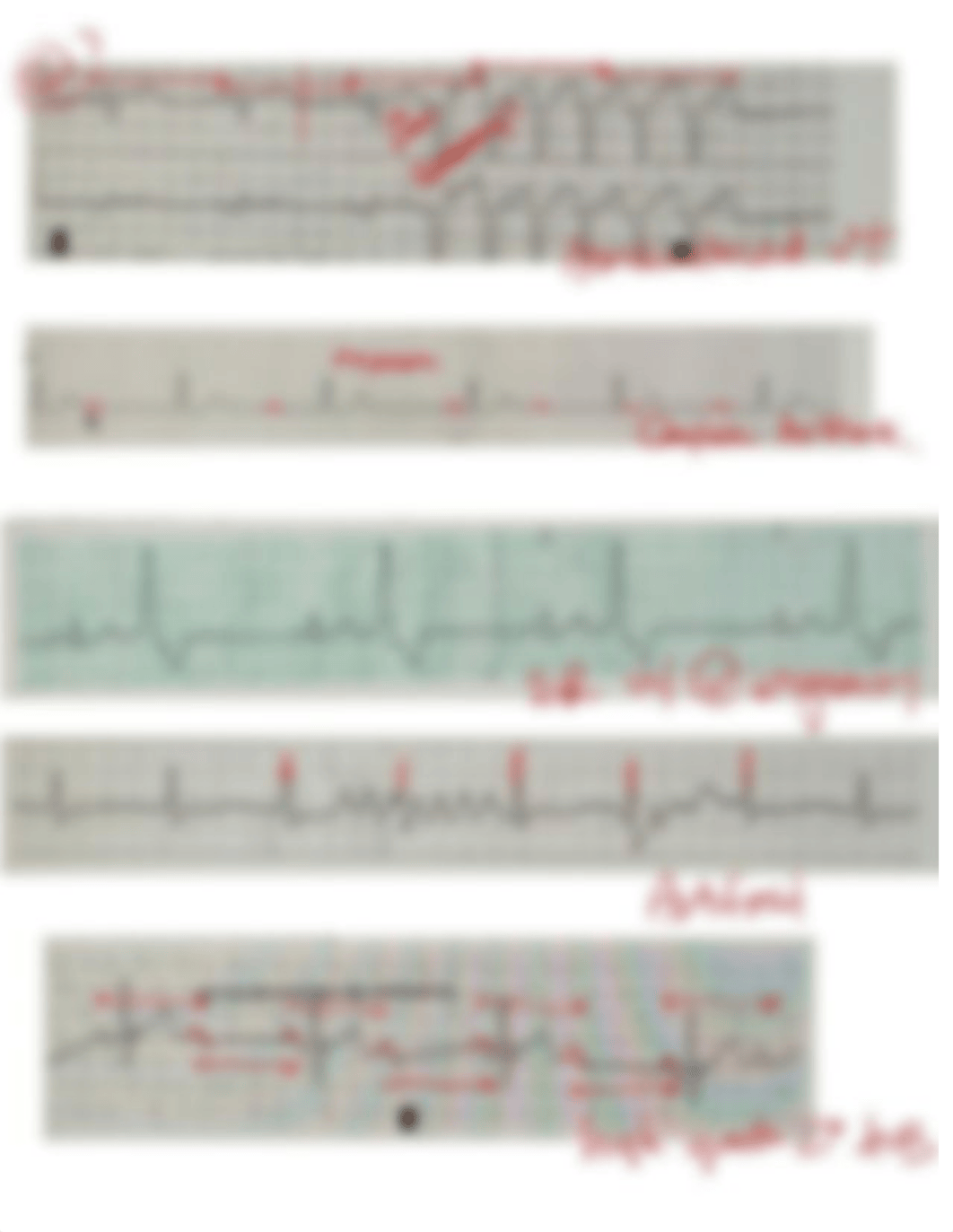 Ekg Final.pdf_d33arqa0zp1_page2