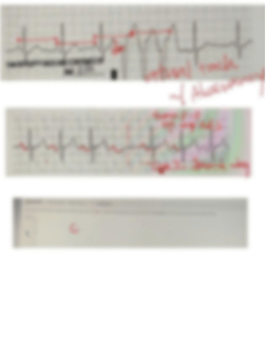 Ekg Final.pdf_d33arqa0zp1_page5