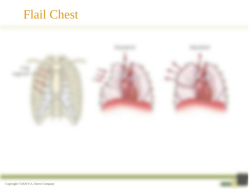 Chest Trauma_Ch27.pptx_d38b0hntsz7_page3