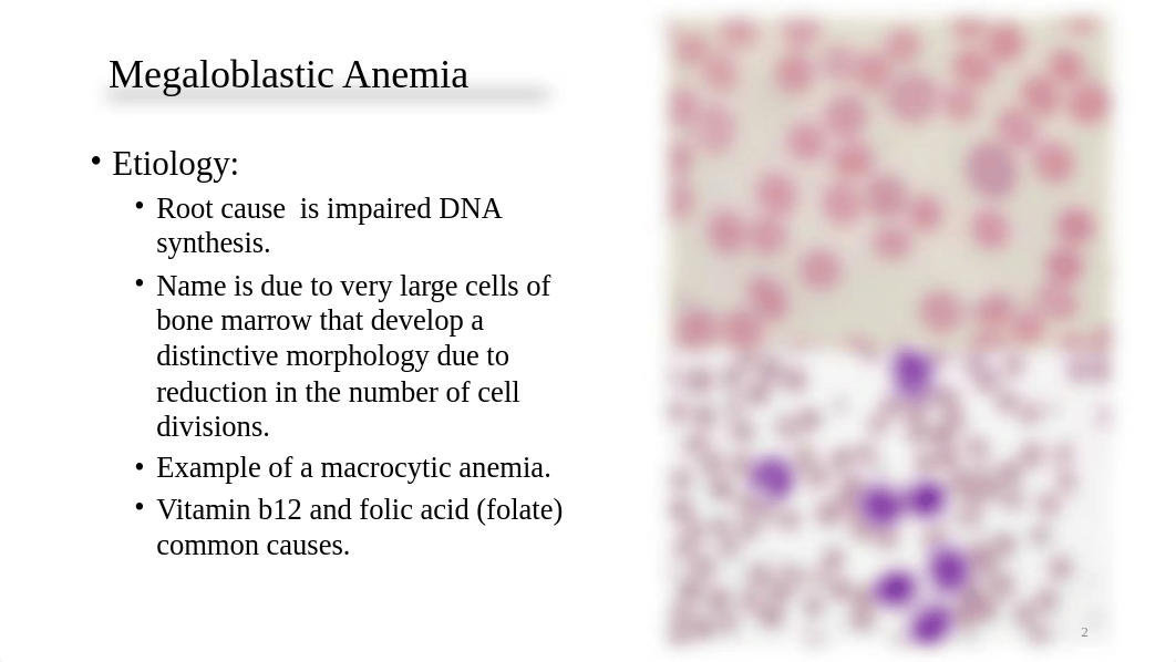 WEEK 2 - Wednesday Lecture - Anemias Caused by Defects of DNA Metabolism - Chapter 18.pptx_d38o7ep9aks_page2