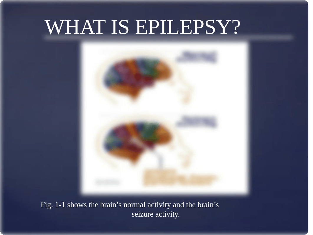 Epilepsy Presentation_d3cfjosg5kc_page3