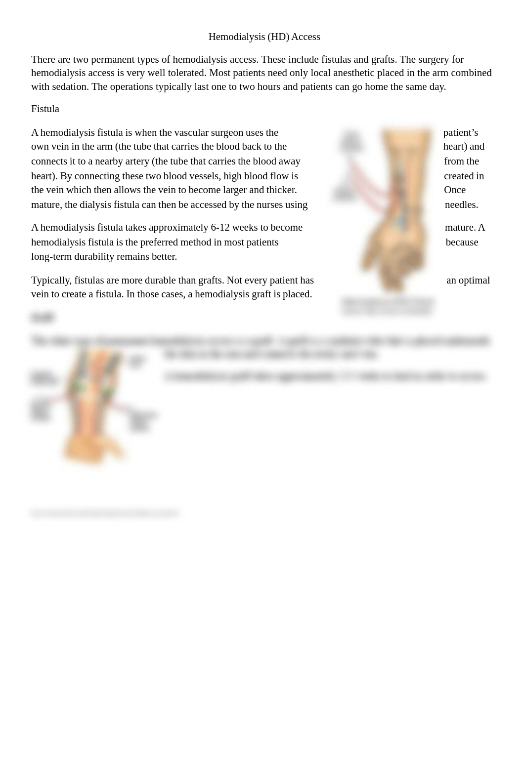 Hemodialysis Access (1).pdf_d3d3wx81u1x_page1