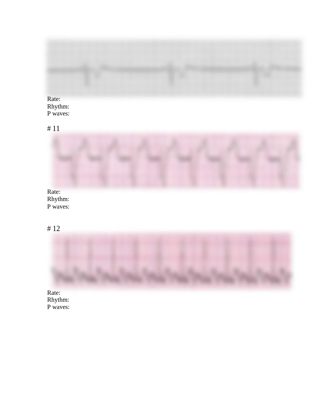 23 ECG Practice Strips STUDENTS.docx_d3fmoha96gv_page4