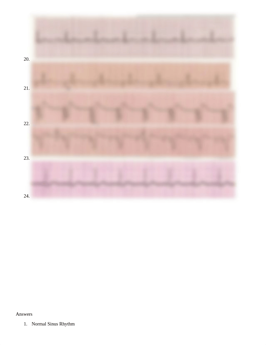 EKG Rhythm Practice.docx_d3fzvdtcxl2_page4