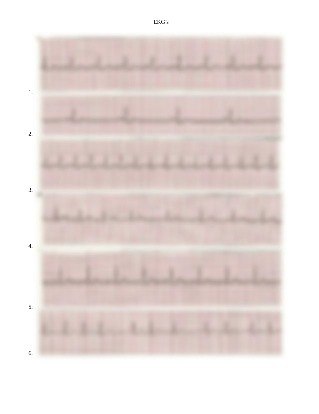 EKG Rhythm Practice.docx_d3fzvdtcxl2_page1