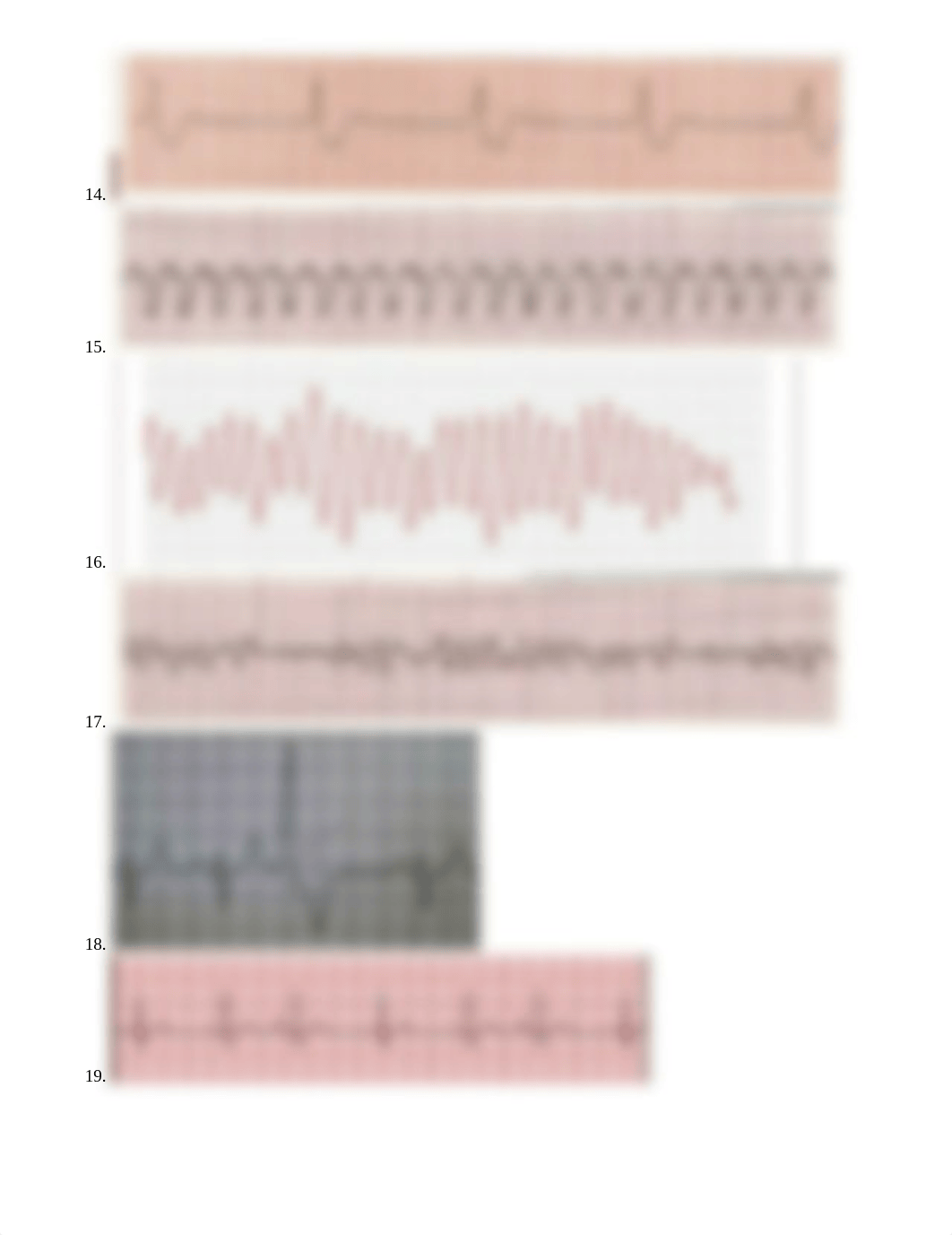 EKG Rhythm Practice.docx_d3fzvdtcxl2_page3