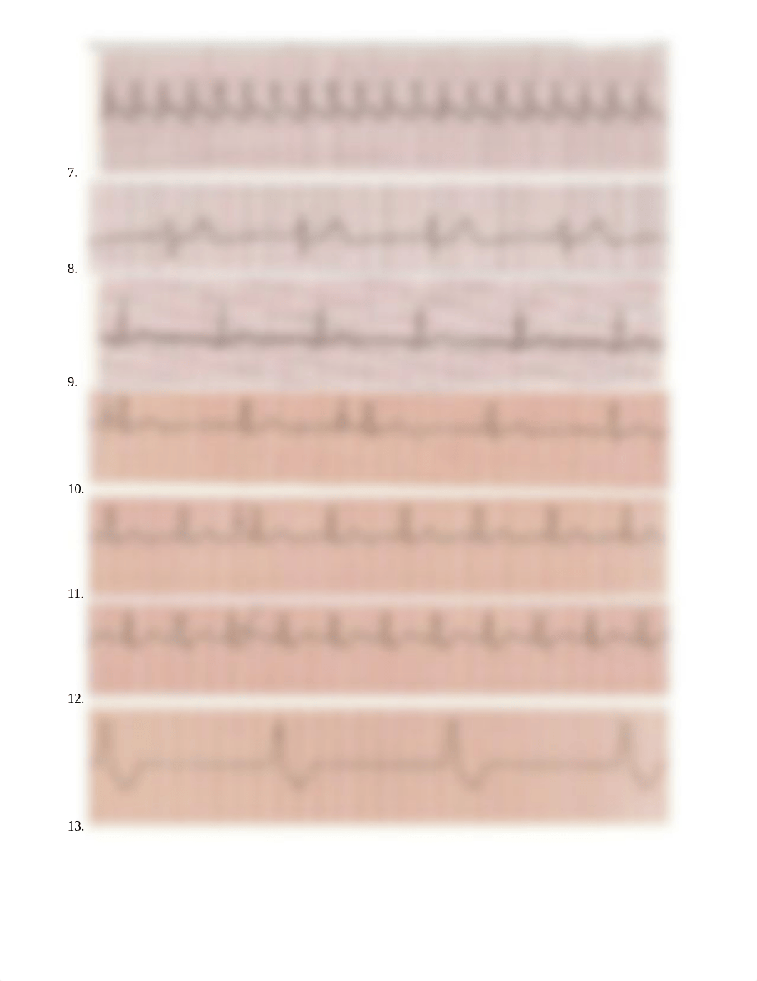 EKG Rhythm Practice.docx_d3fzvdtcxl2_page2