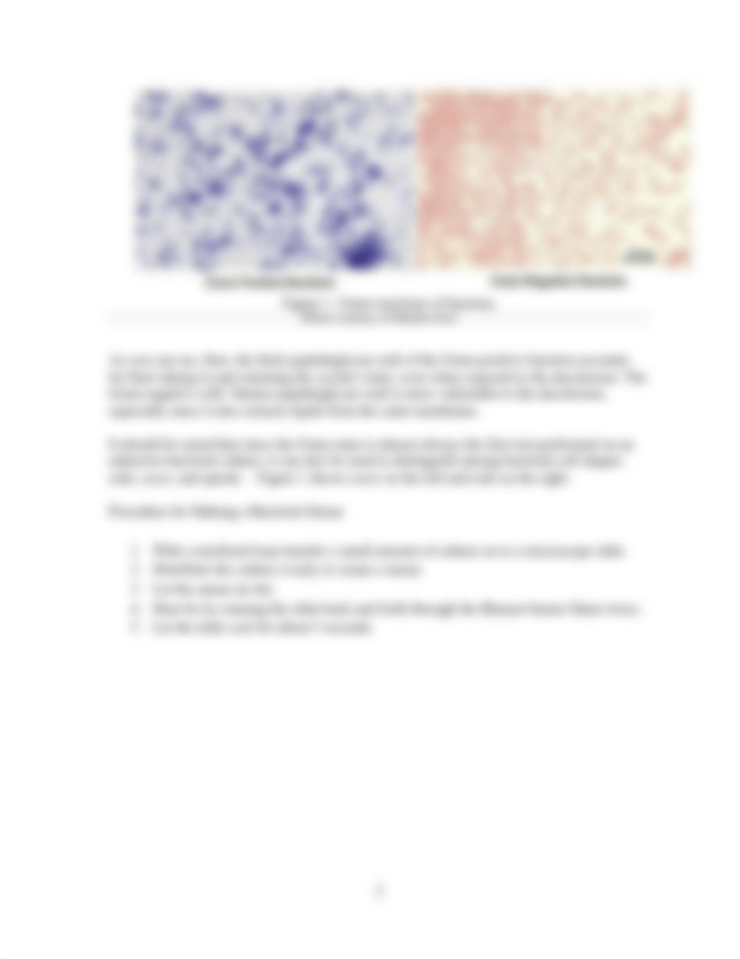 PRE LAB ASSIGNMENT 3 - Gram Staining.docx_d3i0joq6a1o_page2