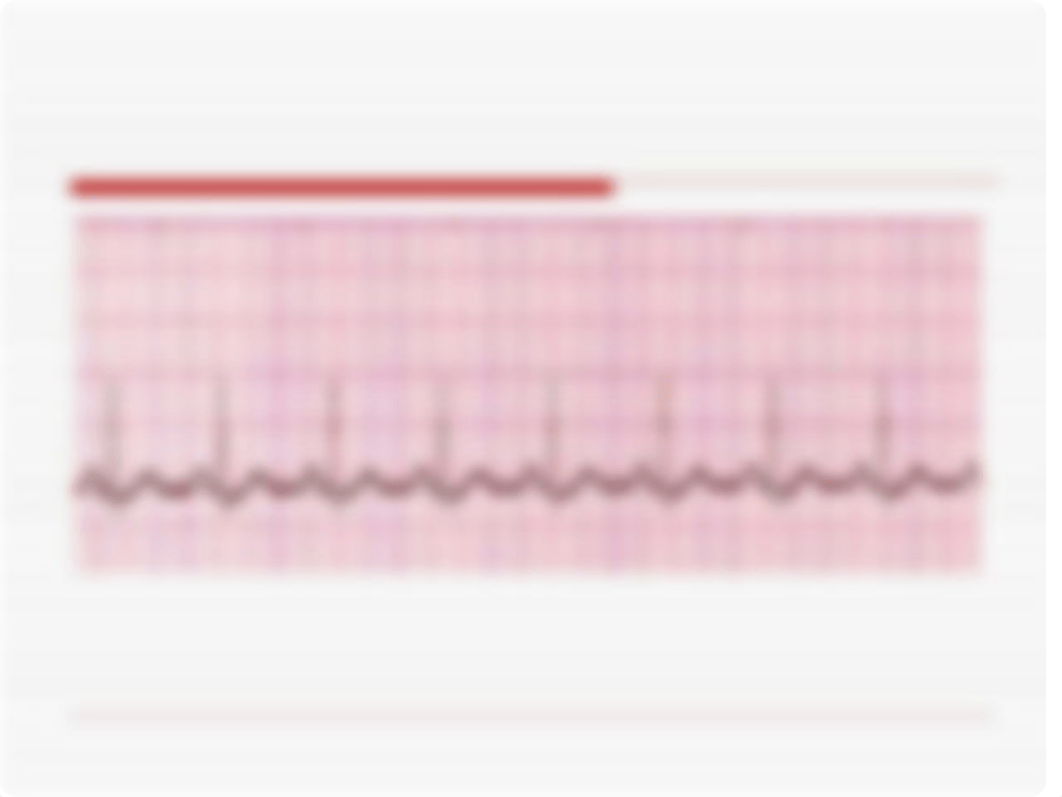 ECG Interpretation_d3kdonka9g8_page3