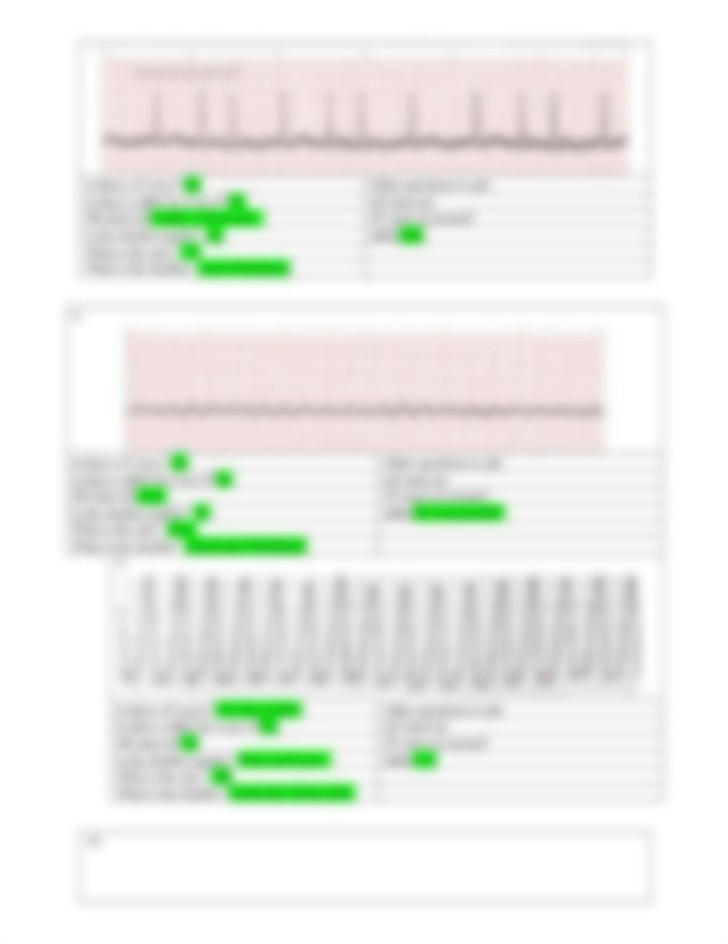 EKG Rhythm Strip Practice KEY Level 2.docx_d3ppa3tenf0_page3