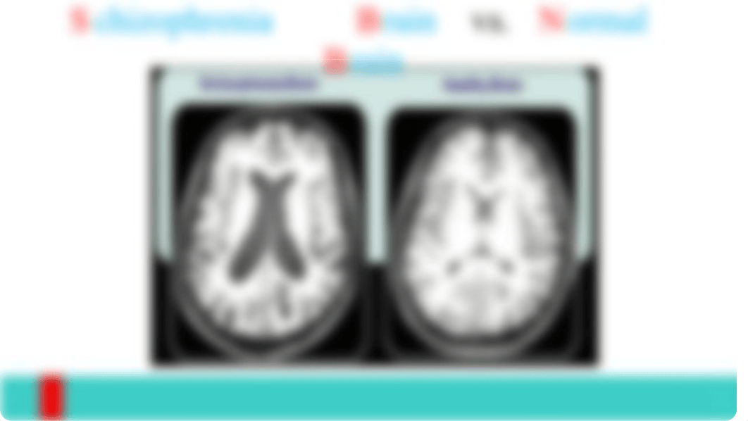 MH Schizophrenia Powerpoint_d3spetxk87n_page5