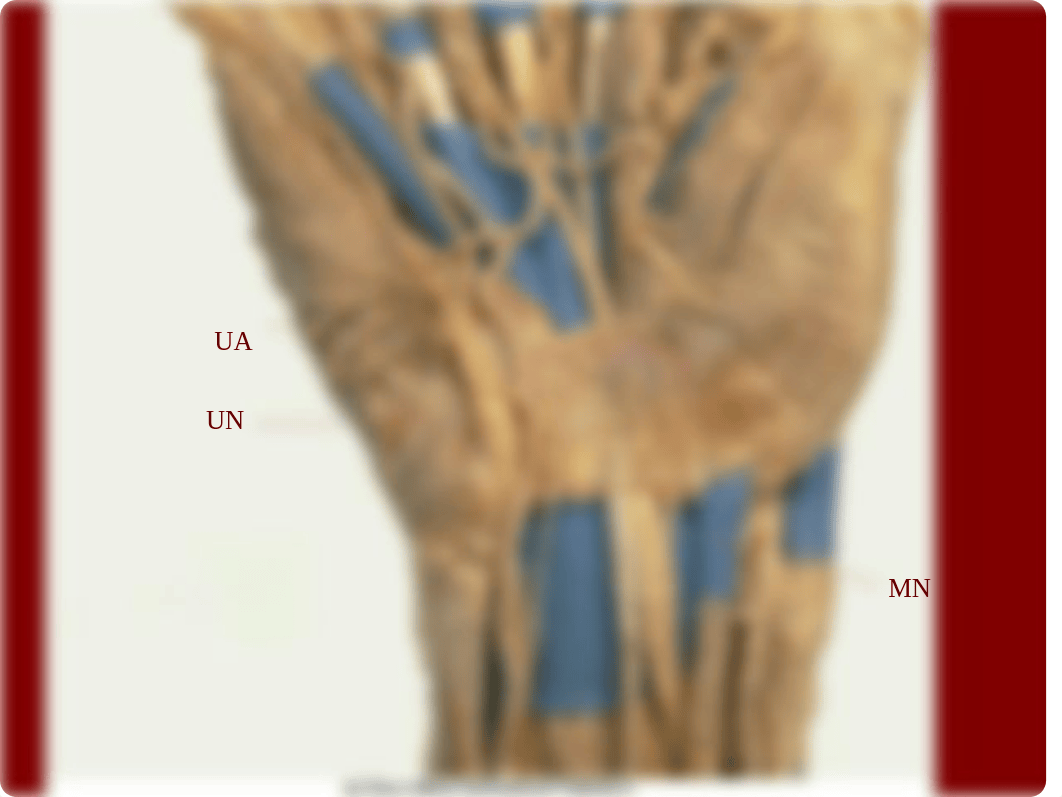 06 Forearm and Hand Muscles_d3u0jcbe2wv_page4