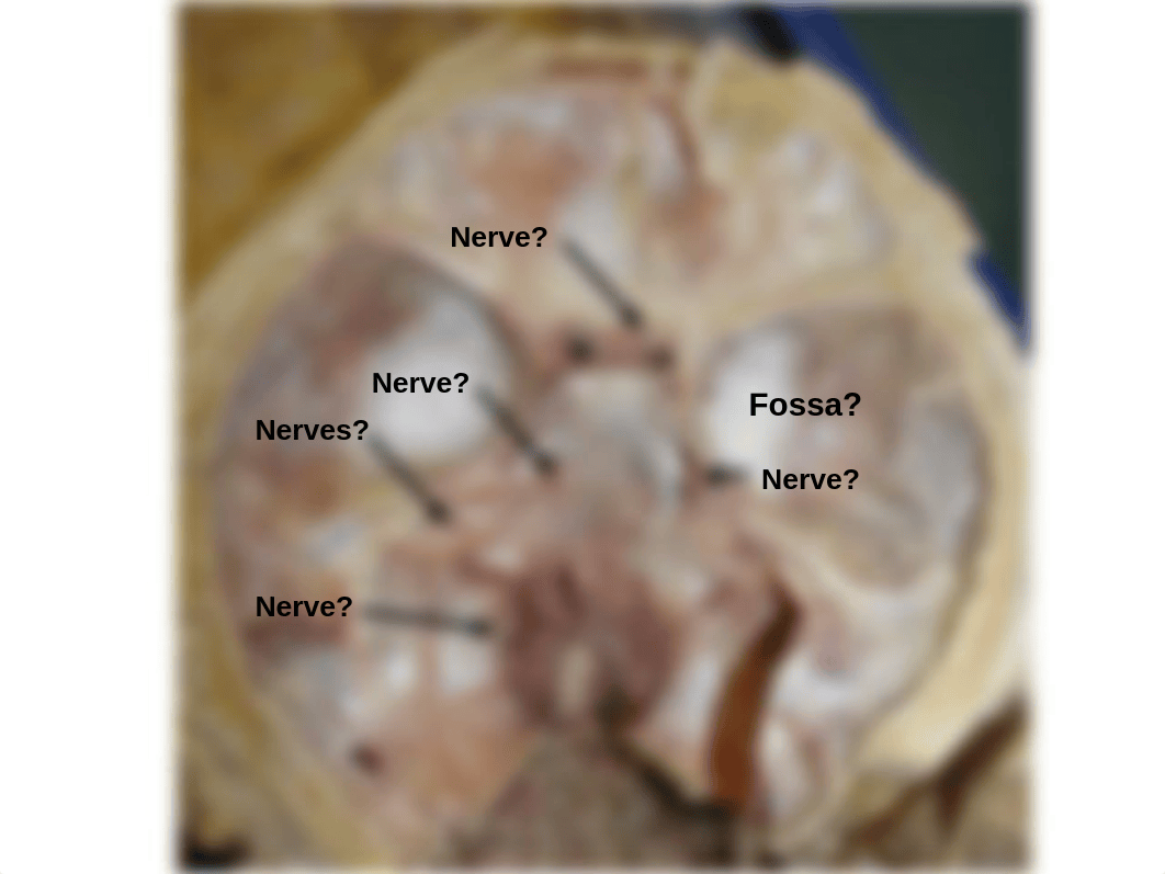 Brain, Meninges Cranial Nerve lab 2016_d3ue2km22w6_page4