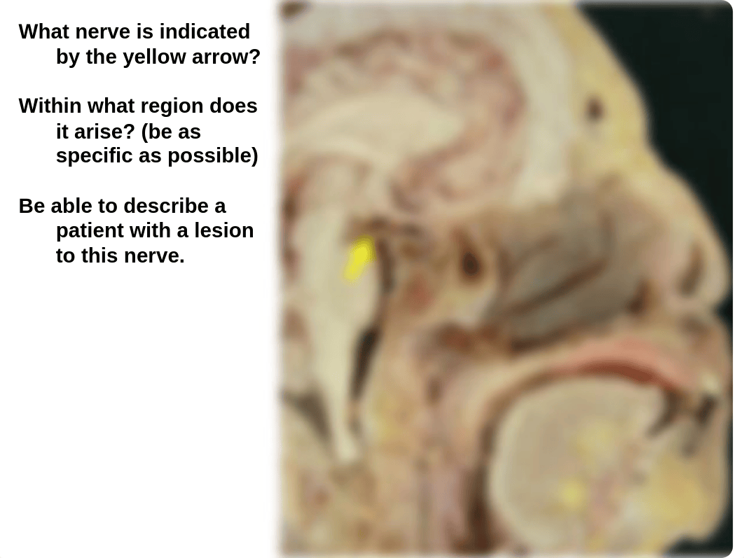 Brain, Meninges Cranial Nerve lab 2016_d3ue2km22w6_page3