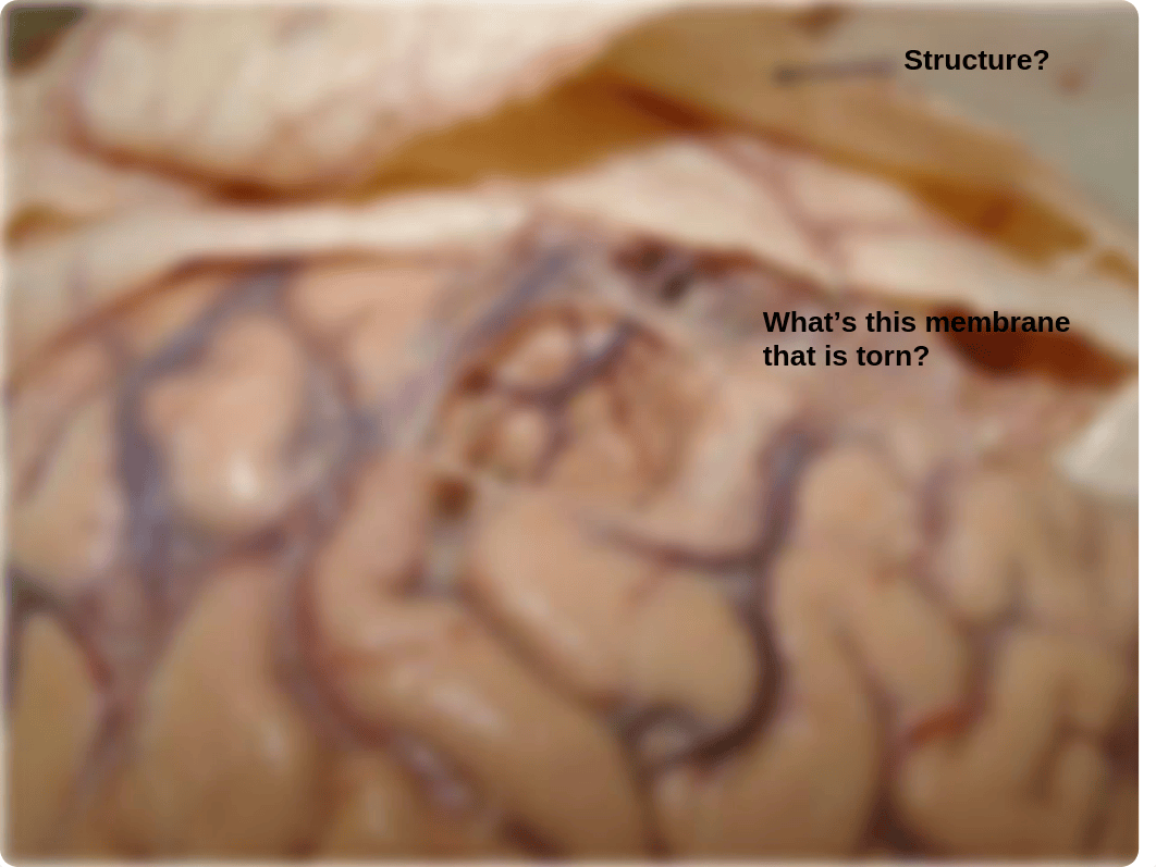 Brain, Meninges Cranial Nerve lab 2016_d3ue2km22w6_page5