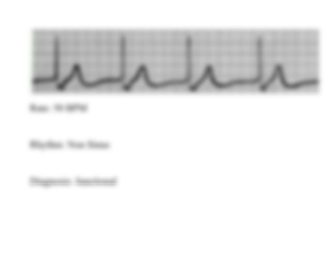 EKG Lab.docx_d3x1eda87sw_page4