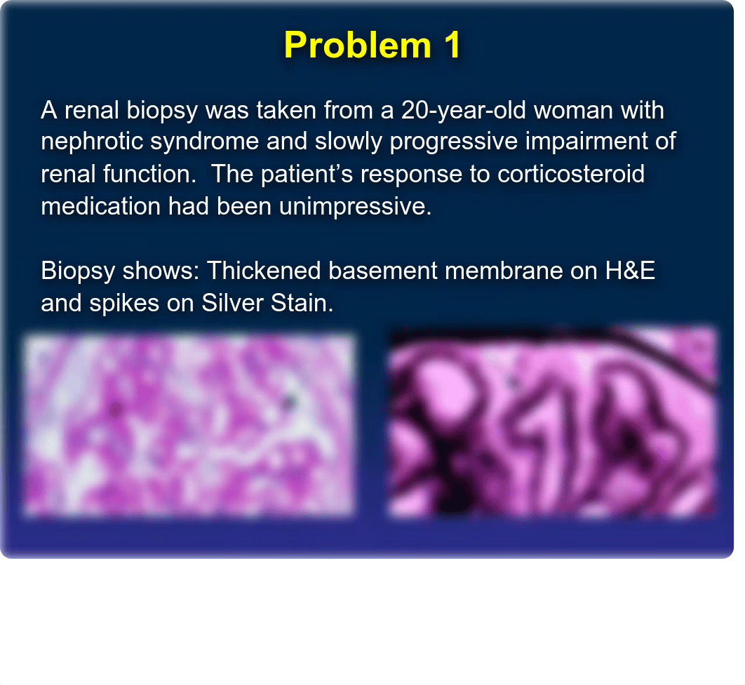 Abreo Glomerular Diseases PSW 2021.pdf_d3x88vm0yyx_page5