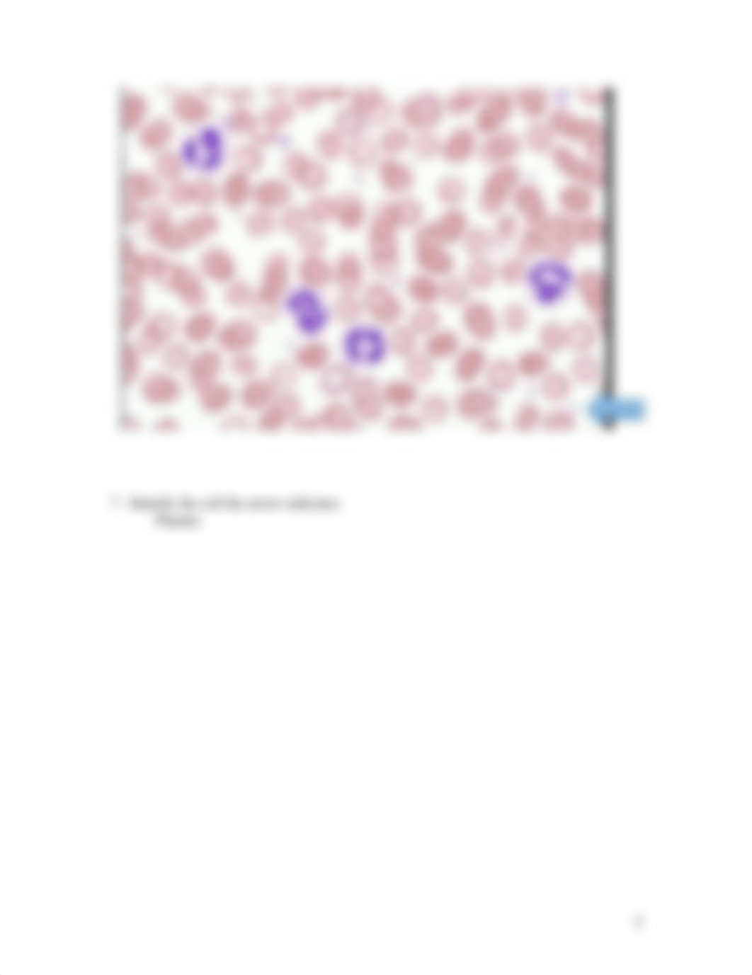 ASSIGNMENT 6.3  MISCELLANEOUS BLOOD (3).docx_d3xj0au74tp_page5