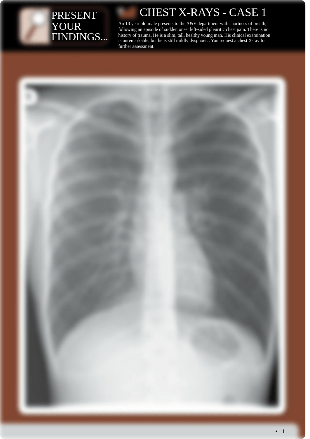 Practice XRAYs.pdf_d3ypjy2xmd3_page1