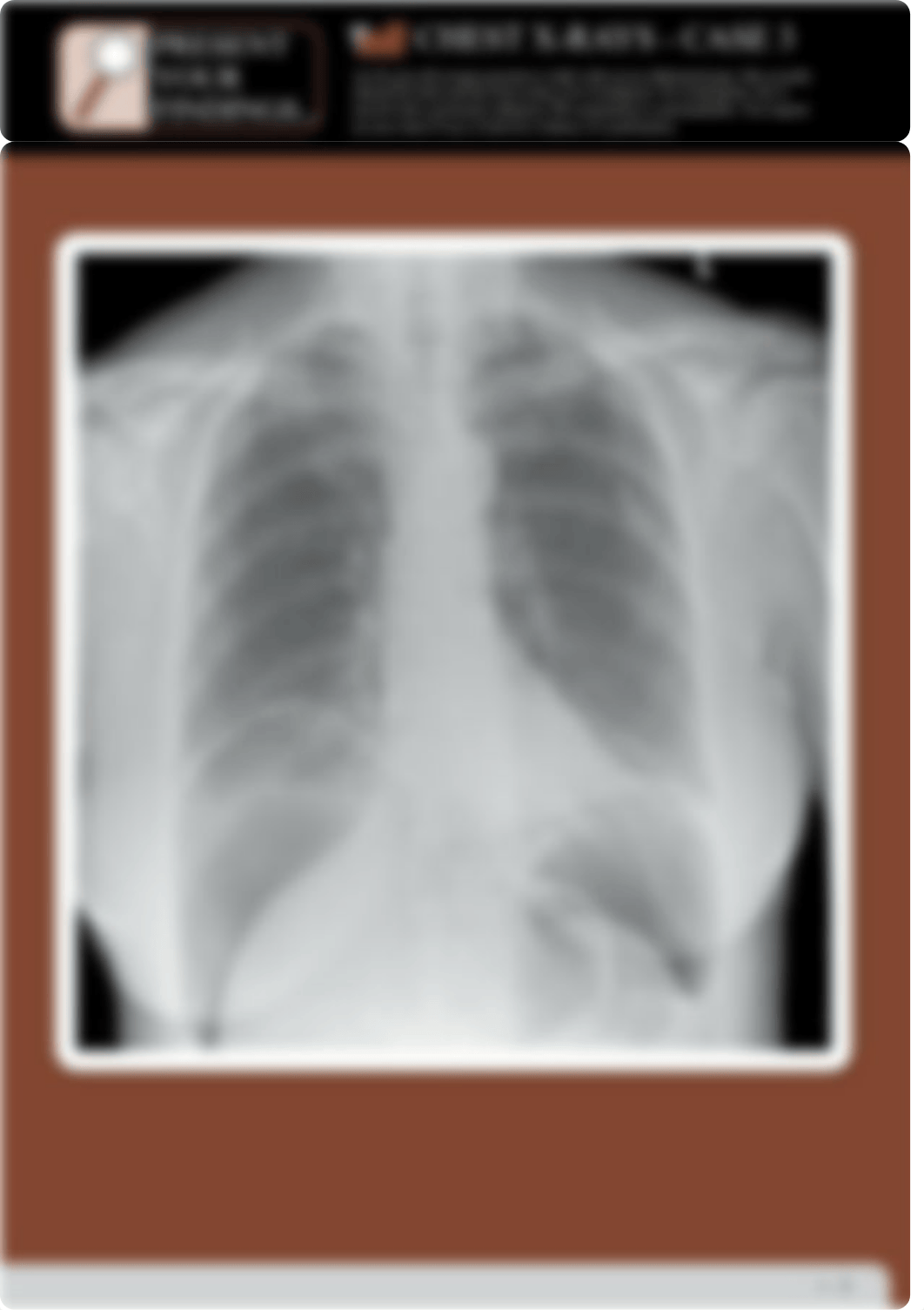 Practice XRAYs.pdf_d3ypjy2xmd3_page5