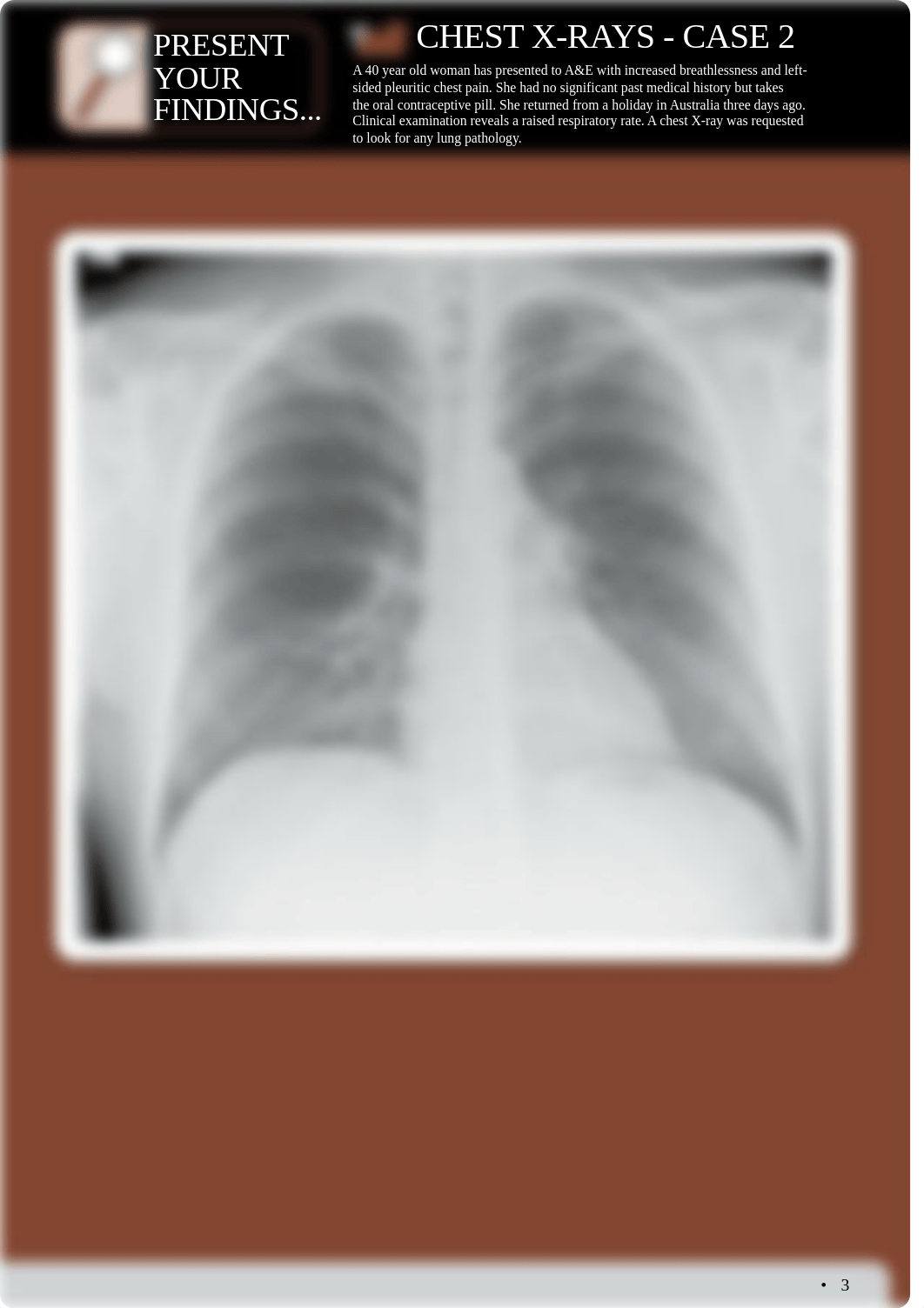 Practice XRAYs.pdf_d3ypjy2xmd3_page3