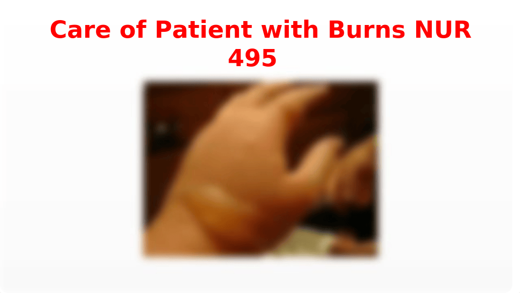 Care of Patient with Burns student.pptx_d400xqbfsnr_page1