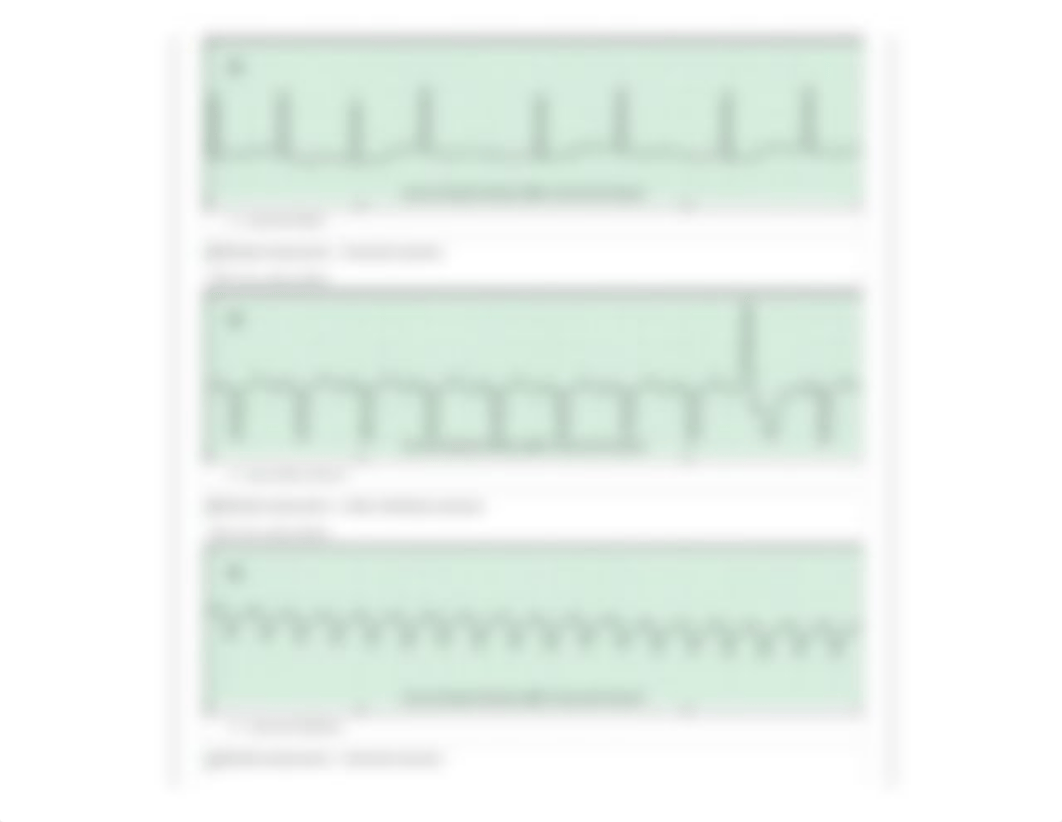 Dysrhythmia - Basic A.pdf_d40vghy3jd3_page3