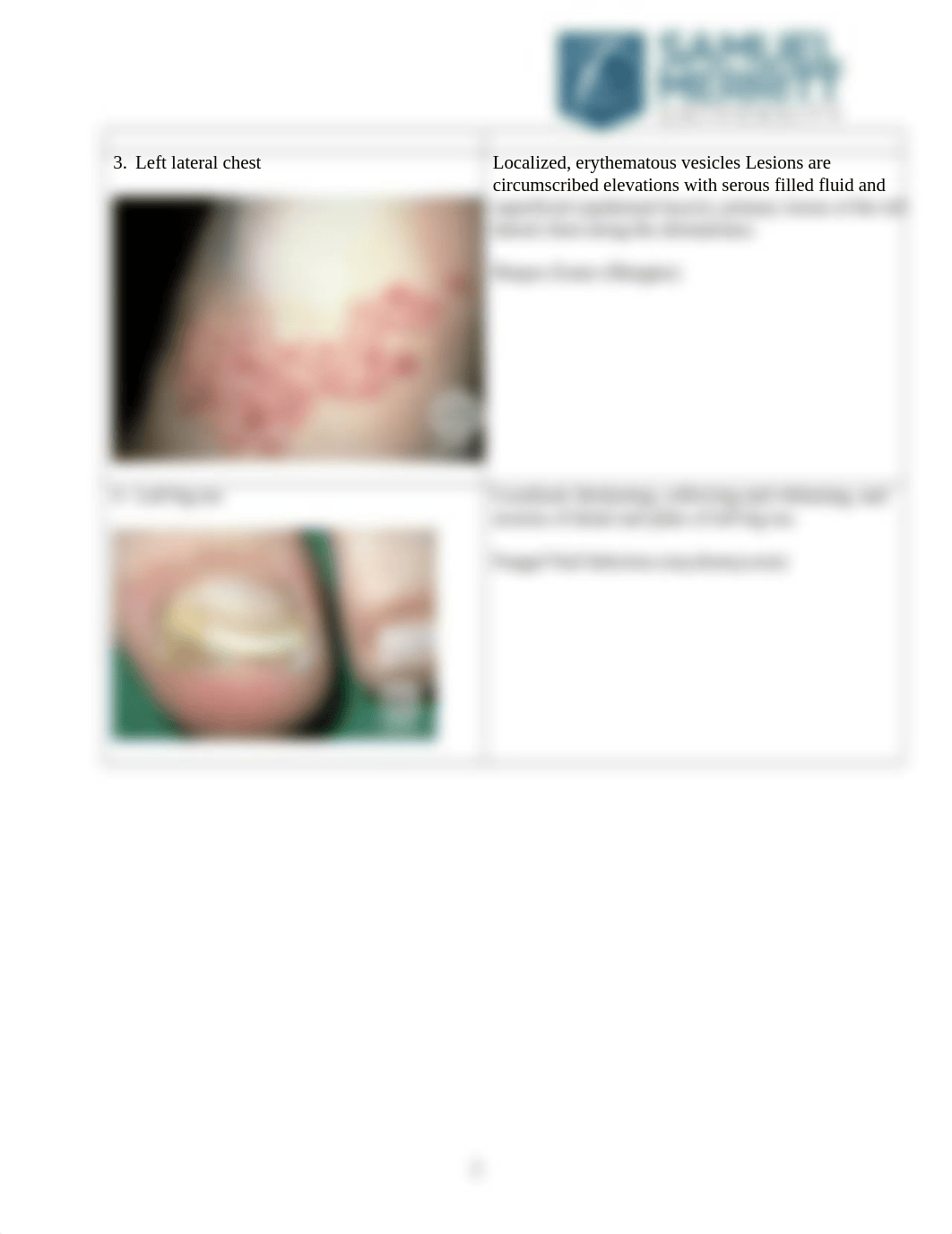 NUR671L-Week 2_Dermatologic_Conditions_Descriptions_Worksheet.docx_d428i925a6x_page2