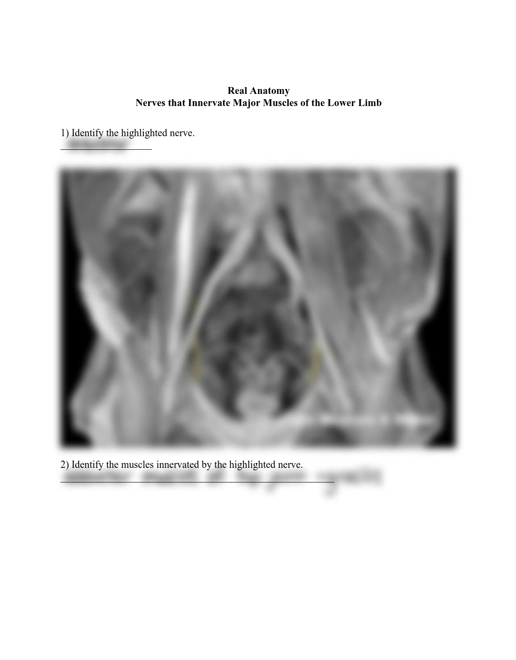 33_nerves_that_innervate_major_muscles_of_the_lower_limb_Worksheet.pdf_d4340jv34k3_page1