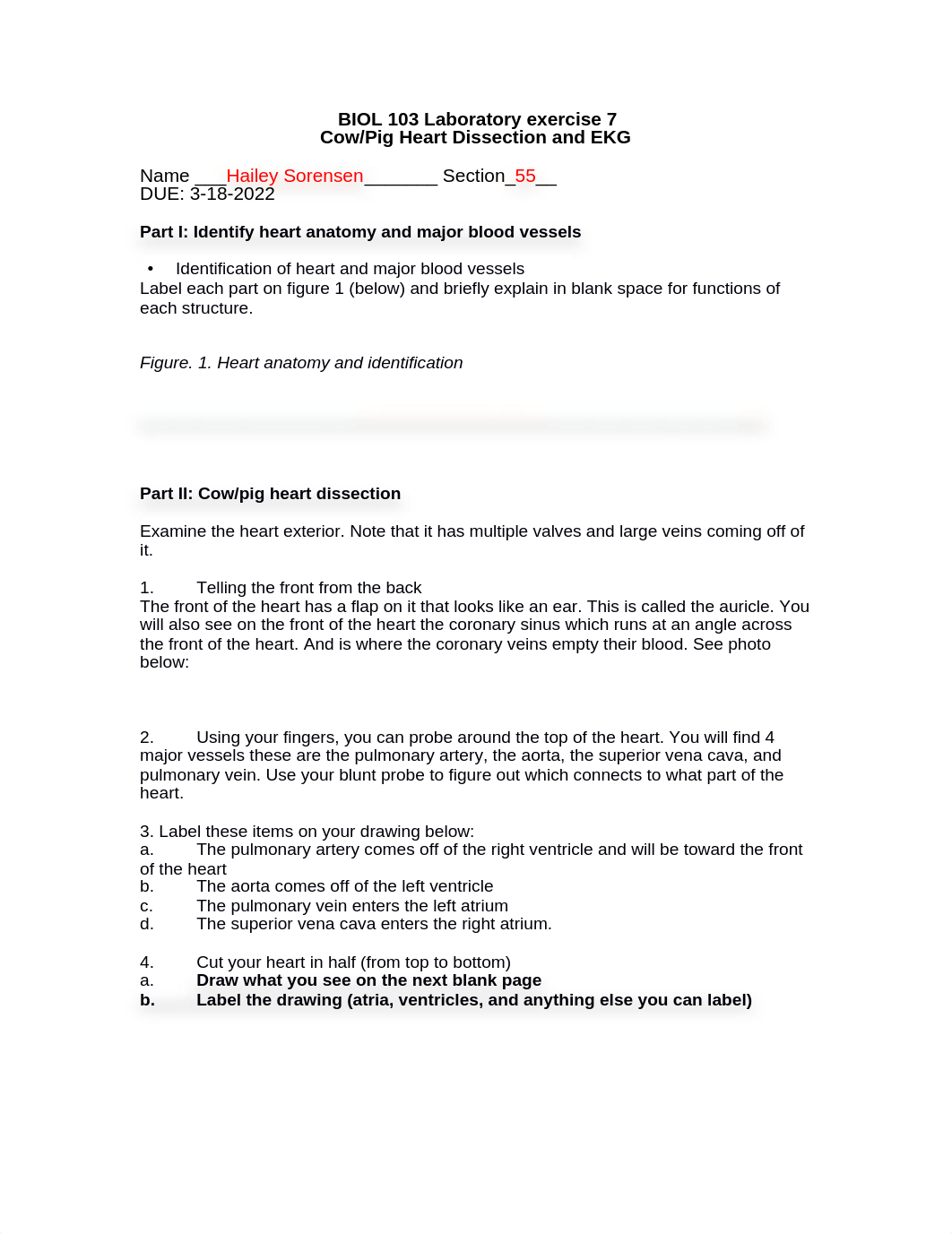 BIOL 103 Lab 7 Cardiovascular EKG Haile.docx_d444oh5d5qj_page1