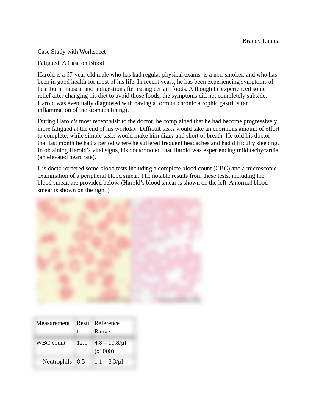 Blood Case Study.docx_d452xs5yekc_page1