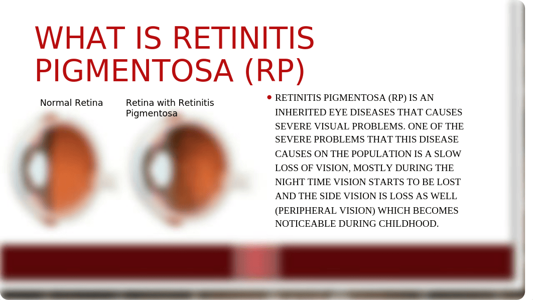 Retinitis Pigmentosa_d45xycw3ev4_page2