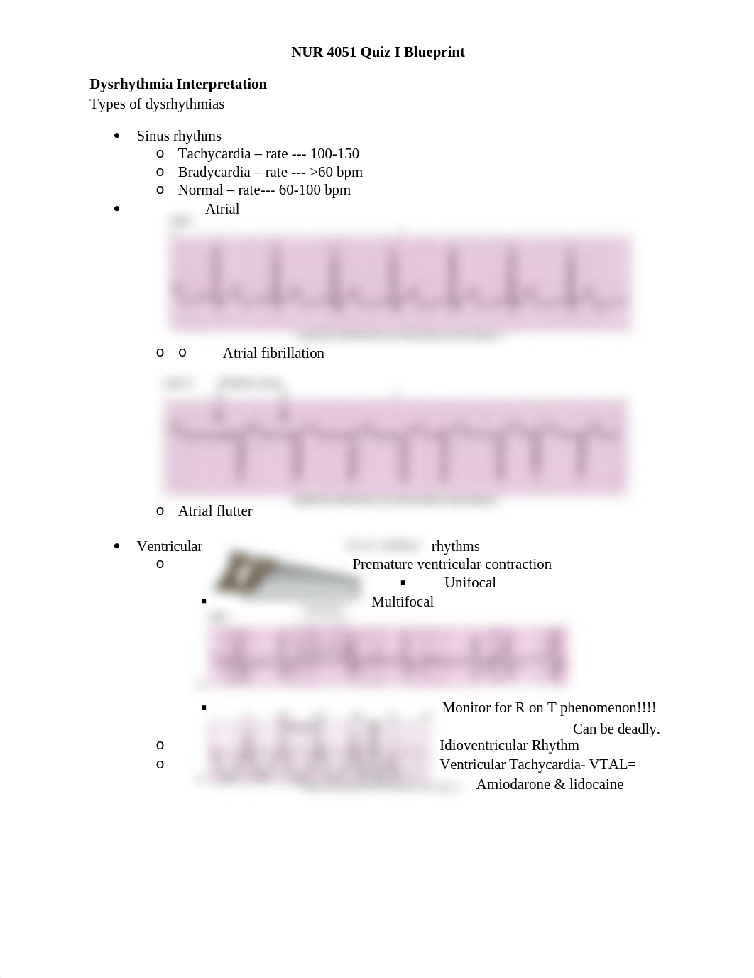 Quiz I Dysrhythmia Blueprint Sp2018.docx_d486ufshq5b_page1