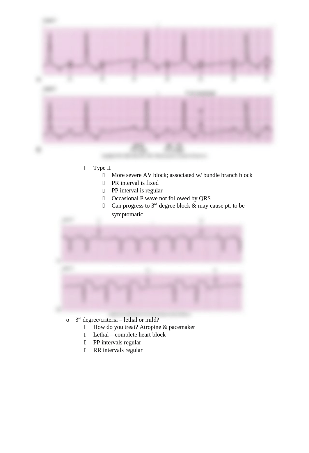 Quiz I Dysrhythmia Blueprint Sp2018.docx_d486ufshq5b_page3