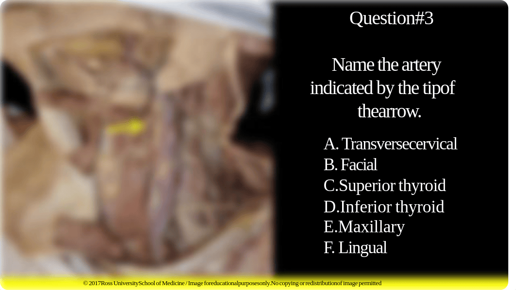 Triangles of the Neck (in_class assessment with answers).pdf_d4fpm5eal0m_page5