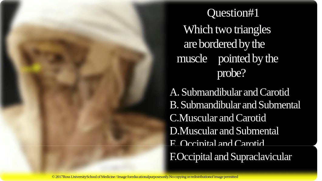 Triangles of the Neck (in_class assessment with answers).pdf_d4fpm5eal0m_page1