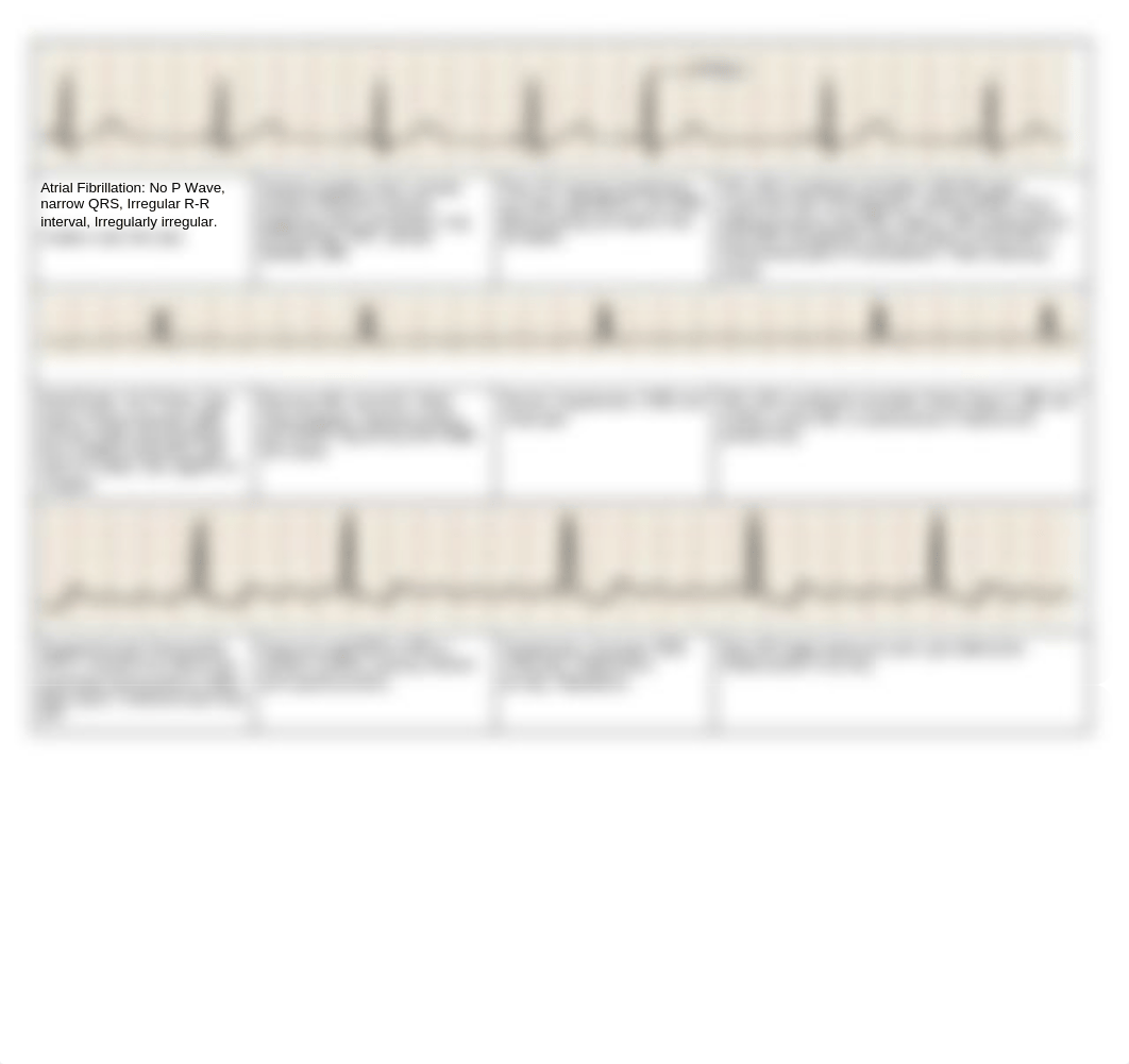 Copy_EKG_Study_Guide_d4g9hudld5k_page2