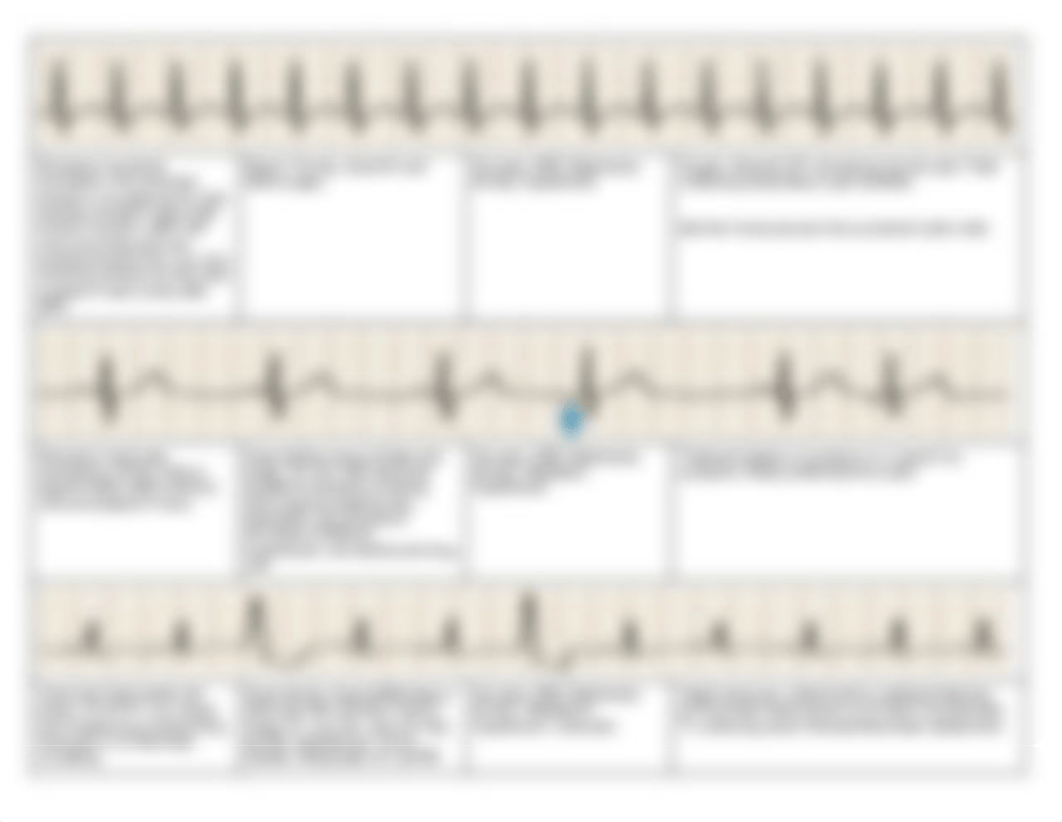 Copy_EKG_Study_Guide_d4g9hudld5k_page3